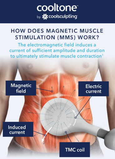 CoolTone Magnetic Muscle Stimulation
